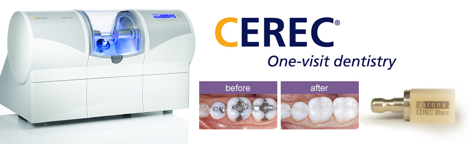 CEREC Same-day Dental Restorations